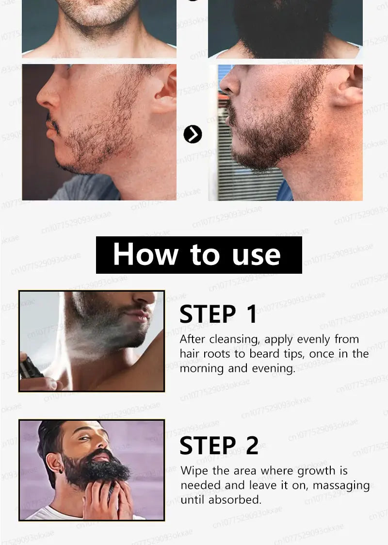 The most effective beard growth essence in 2025, grow a thick beard in 7 days. Chest hair, leg hair, beard and hair growth