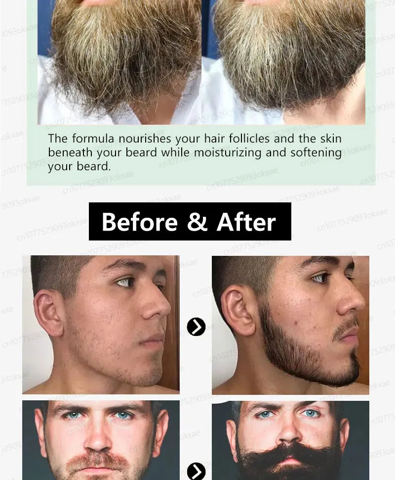 The most effective beard growth essence in 2025, grow a thick beard in 7 days. Chest hair, leg hair, beard and hair growth