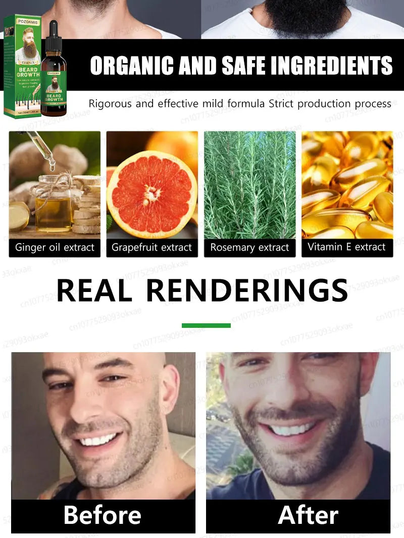 The most effective beard growth essence in 2025, grow a thick beard in 7 days. Chest hair, leg hair, beard and hair growth