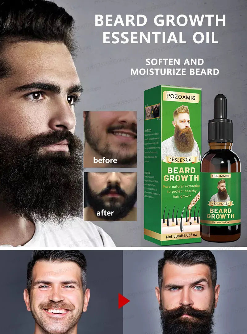The most effective beard growth essence in 2025, grow a thick beard in 7 days. Chest hair, leg hair, beard and hair growth