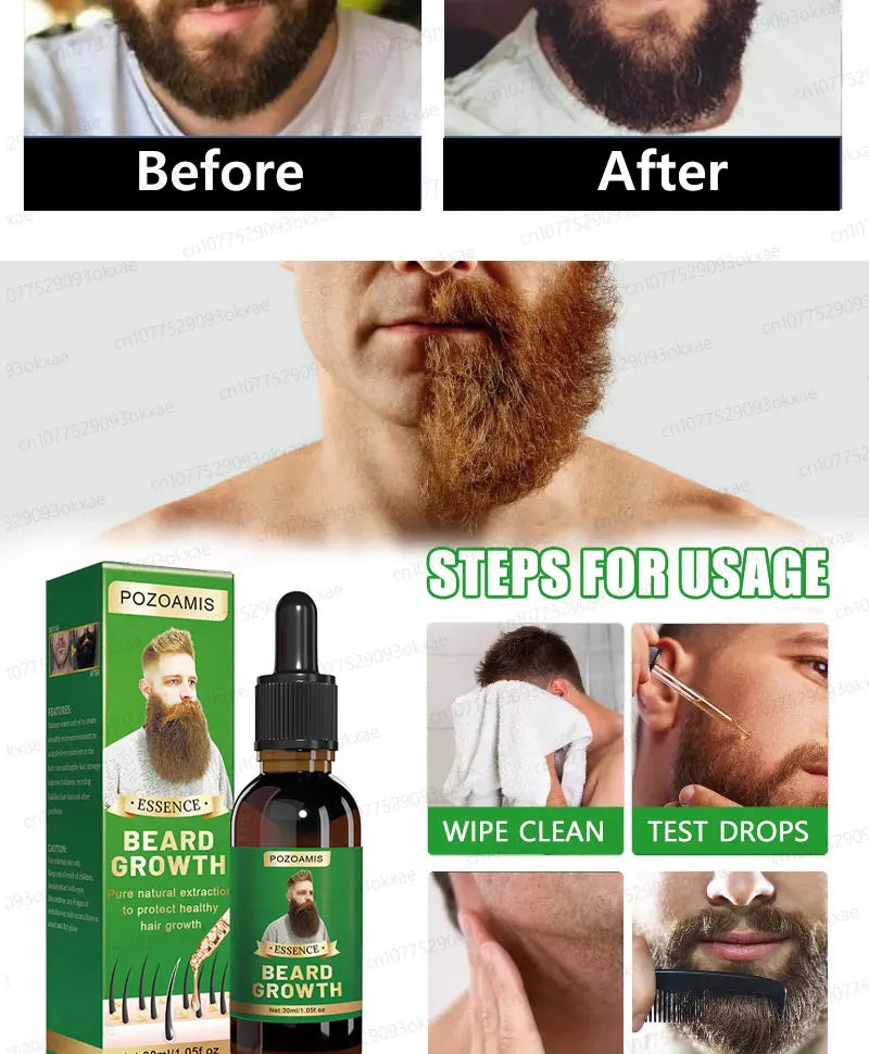 The most effective beard growth essence in 2025, grow a thick beard in 7 days. Chest hair, leg hair, beard and hair growth